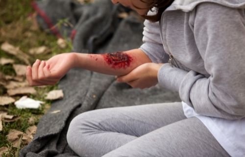 Hand Injury attorney | spiro k pistiolas