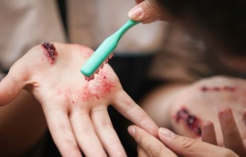 Hand Injury attorney | spiro k pistiolas