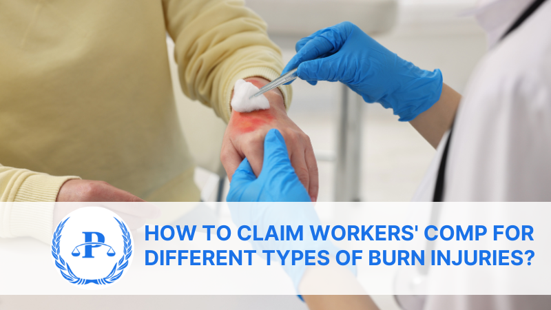 How to file a workers' compensation claim for different types of burn injuries? | Pistiolas