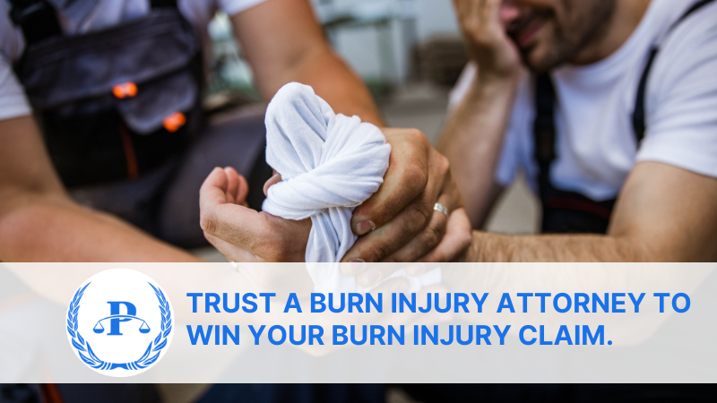 _Trust a Burn Injury Attorney to Win Your Burn Injury Claim. | Pistiolas Law