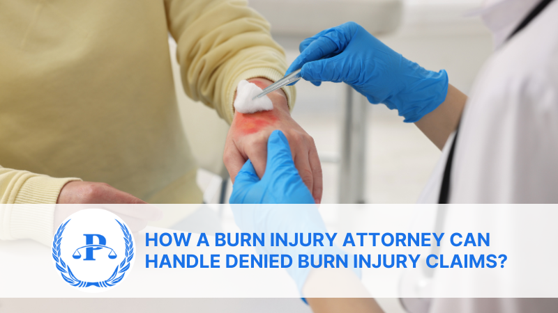 How a Burn Injury Attorney Can Handle Denied burn injury Claims | Pistiolas Law