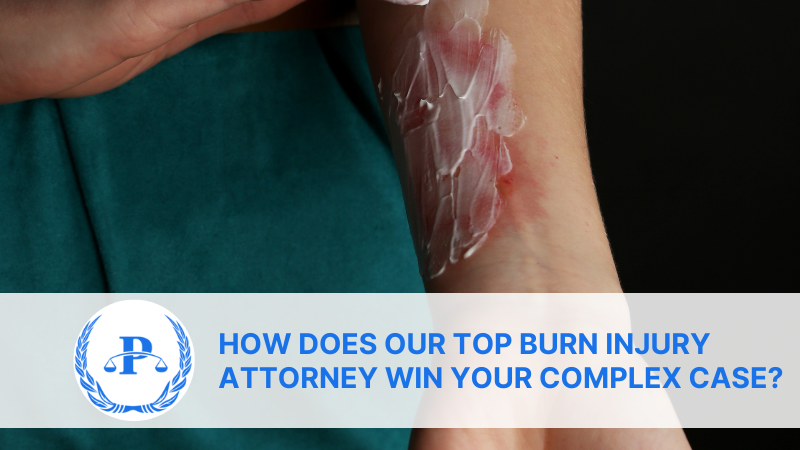 How Does Our Top Burn Injury Attorney Win Your Complex Case | Pistiolas Law