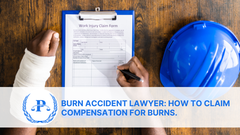 Burn Accident Lawyer: How to Claim Compensation for Burns.